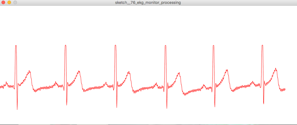 Ukázka Processing pro EKG monitoring srdeční frekvence AD8232
